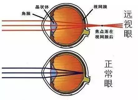 磨望远镜镜片